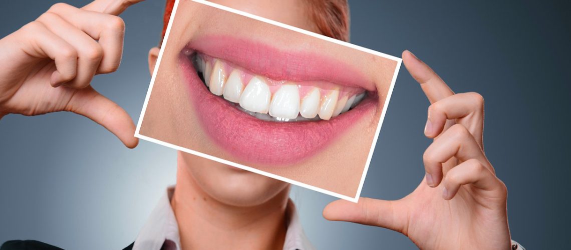 White teeth are a reflection of flawless dental hygiene